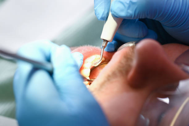 Best Emergency Treatment for Toothache in Colbert, OK